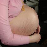 Kako zategniti kožo na trebuhu po porodu in hujšanju?